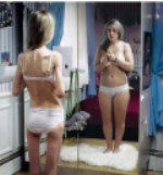 anorexia, bulimia, anorexia nervosa