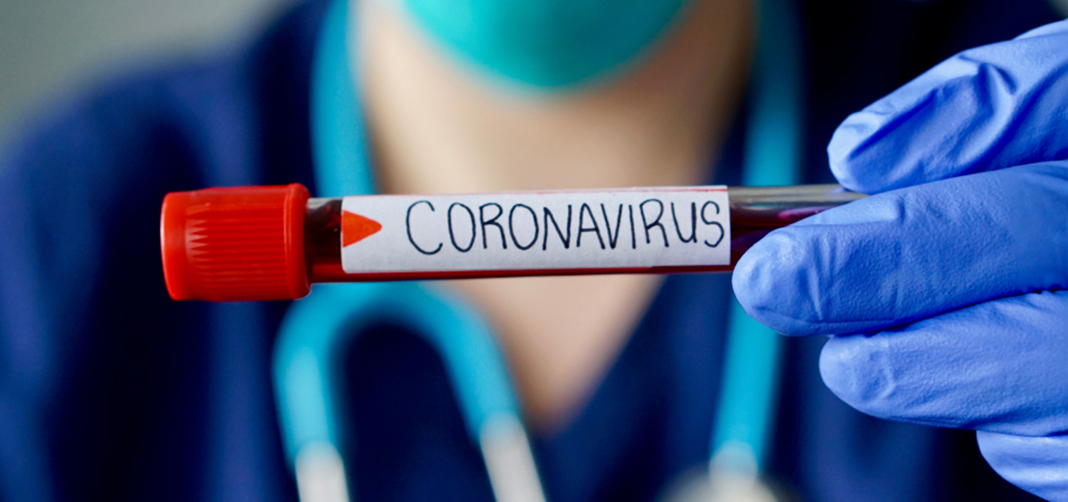 “En EEUU hay un riesgo muy bajo de contacto con el coronavirus”