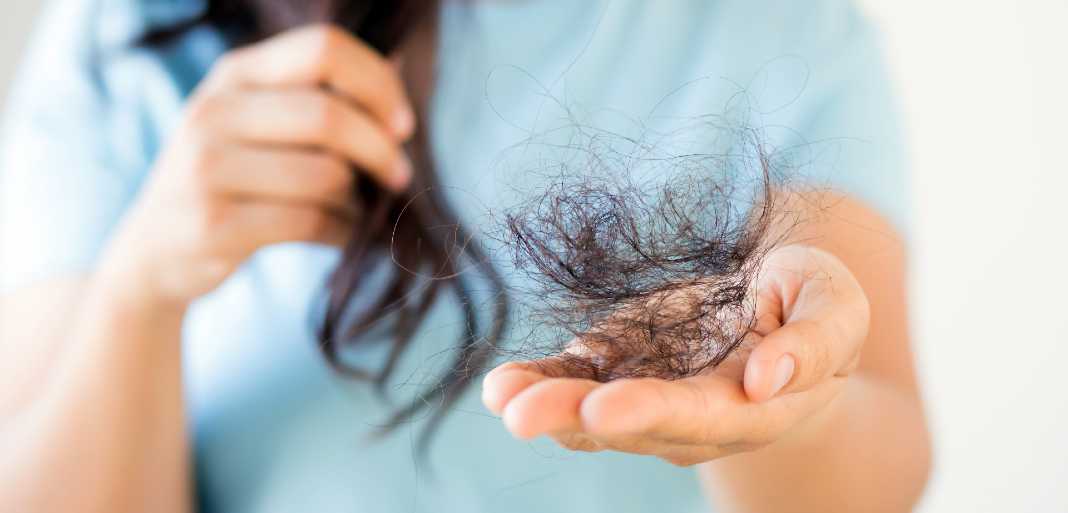 Mujeres: cómo detener la pérdida del cabello